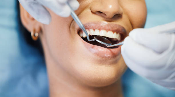 Best Emergency Dental Care for Broken or Chipped Teeth in Lexington, KY